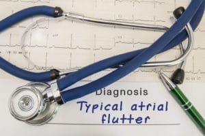 Atrial Flutter Birmingham AL